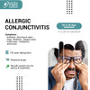 ALLERGIC CONJUNCTIVITIS