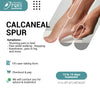 PAINFUL CALCANEOUS SPUR