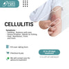 CELLULITIS