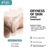 DRYNESS OF SKIN