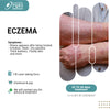 ECZEMA