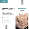 ESOPHAGITIS