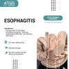 ESOPHAGITIS