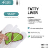 FATTY LIVER