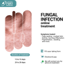 FUNGAL SKIN INFECTIONS