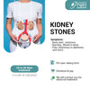 KIDNEY STONE