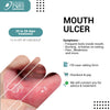 MOUTH ULCERS