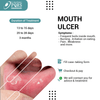 MOUTH ULCERS