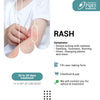 RASH