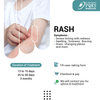 RASH