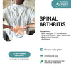 SPINAL ARTHRITIS