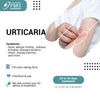 URTICARIA