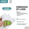 CIRRHOSIS