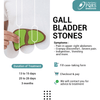GALL BLADDER STONE