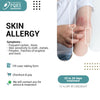 SKIN ALLERGY