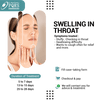 SWELLING IN THROAT